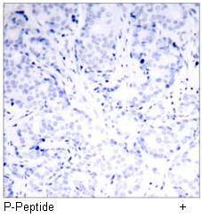 GATA1 (Phospho-Ser142) Antibody