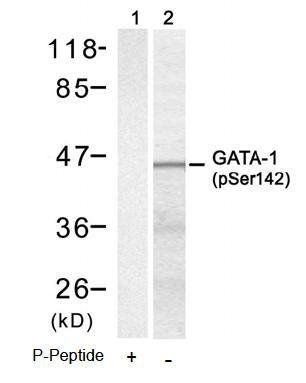 GATA1 (Phospho-Ser142) Antibody