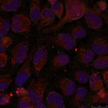 GATA1 (Phospho-Ser142) Antibody