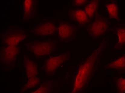 GATA1 (Phospho-Ser310) Antibody