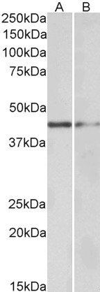 GATA3 antibody