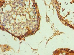 GATA3 Antibody