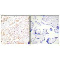 GATA3/GATA2 Antibody