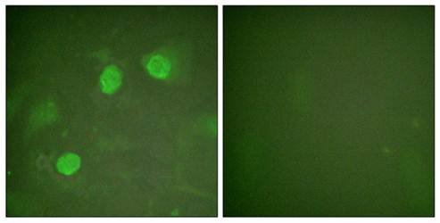 GATA3 (Ab-308) Antibody