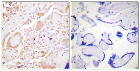 GATA3 (Ab-308) Antibody
