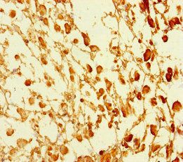 GATA6 Antibody