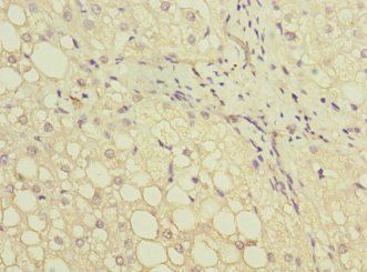 GATC Antibody