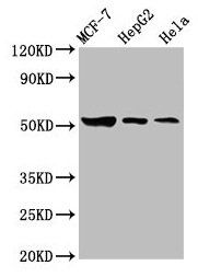 GBA antibody