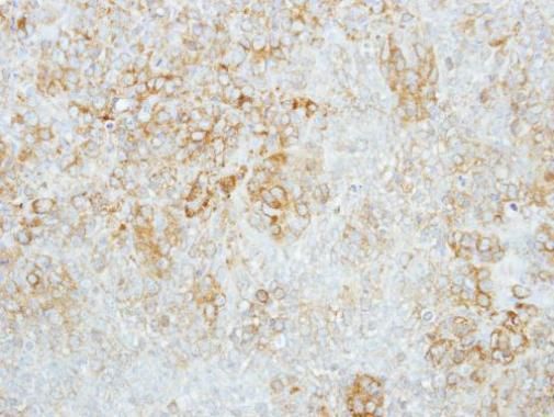 GBA antibody [C1C3]