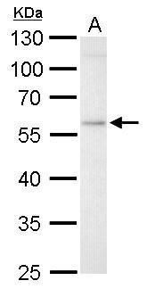GBA antibody