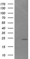 GBA3 Antibody