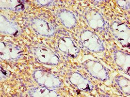 GBP1 Antibody