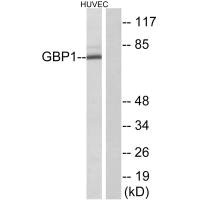 GBP1 antibody