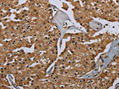 GBP5 Antibody