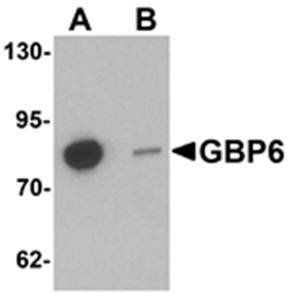 GBP6 Rabbit Polyclonal Antibody