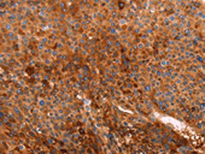 GC Antibody