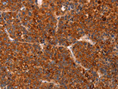 GC Antibody