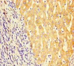 GCDH Antibody