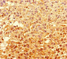 GCDH Antibody
