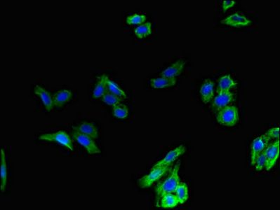 GCGR Antibody