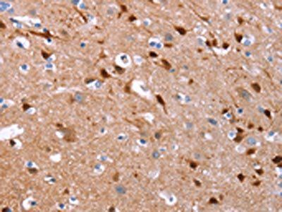 GCGR Antibody