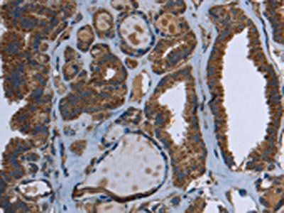 GCK Antibody
