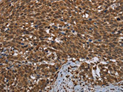 GCK Antibody