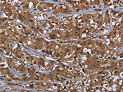 GCK Antibody