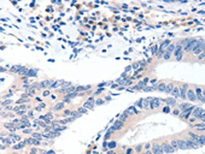 GCK Antibody