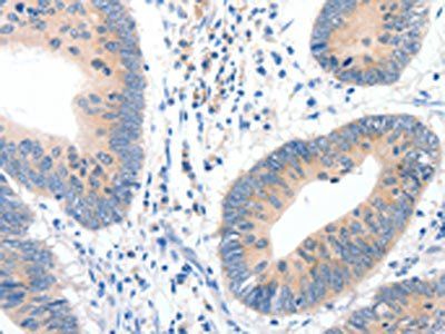 GCK Antibody