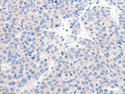 GCK Antibody