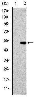 GCK Antibody