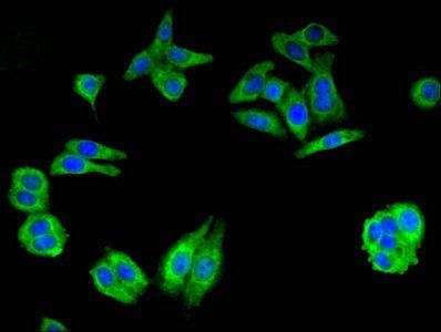 GCLM antibody