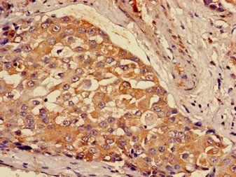 GCLM Antibody