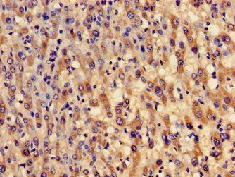 GCLM Antibody