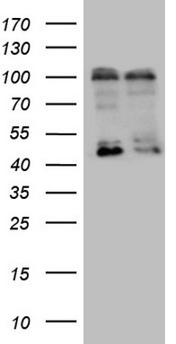 GCM1 Antibody