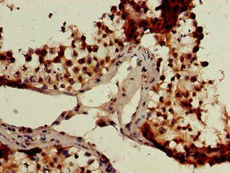 GCM2 Antibody