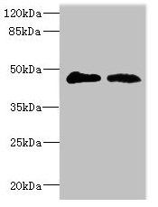 GCNT2 antibody