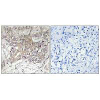 GCNT3 Antibody
