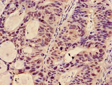 GCNT3 Antibody