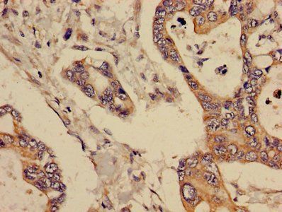 GCNT3 Antibody