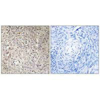 GCNT7 Antibody