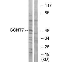 GCNT7 antibody