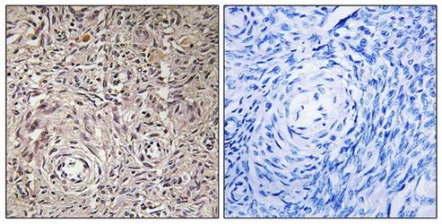 GCNT7 Antibody