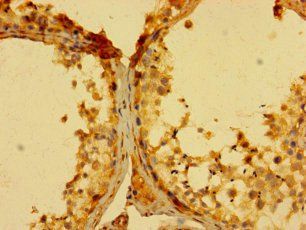 GCSAM antibody