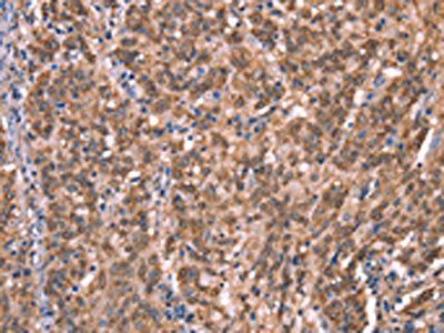 GCSAM antibody