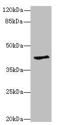 GDAP1L1 antibody