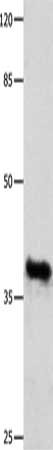 GDF15 Antibody