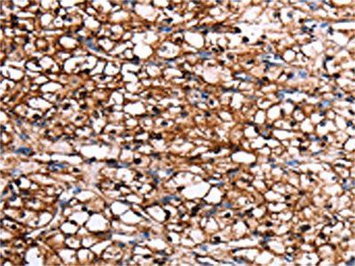 GDF15 Antibody