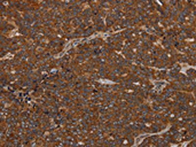 GDF2 Antibody